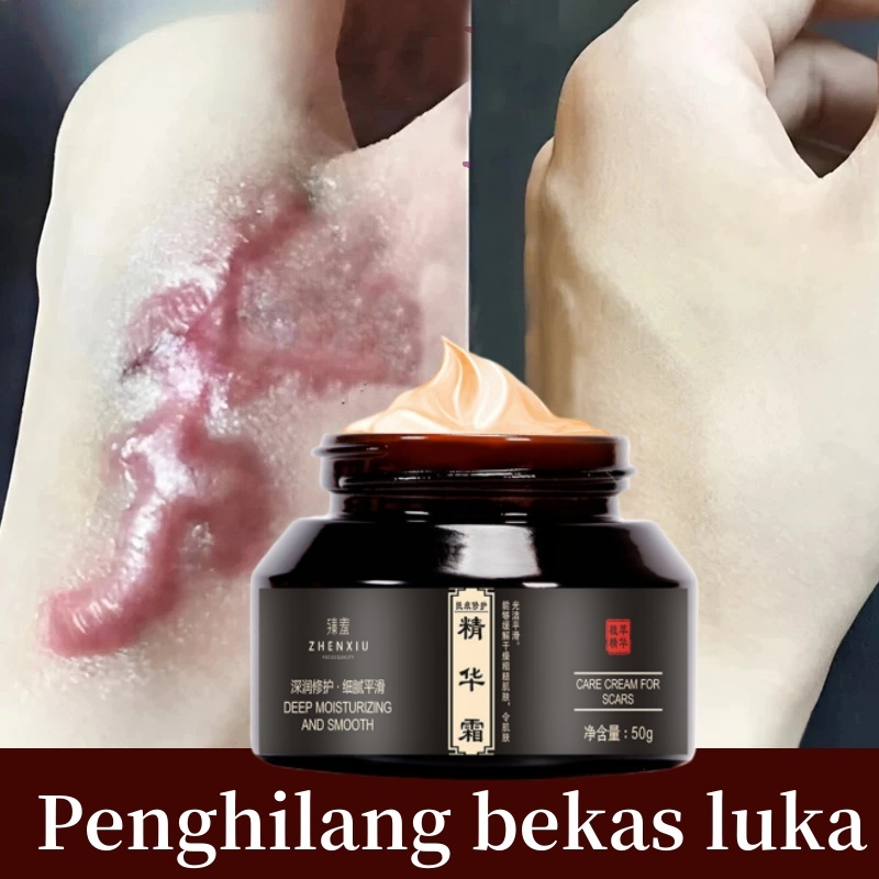 salep penghilang bekas luka Cream Penghilang Bekas Luka cream penghilang bekas luka Obat Penghilang 