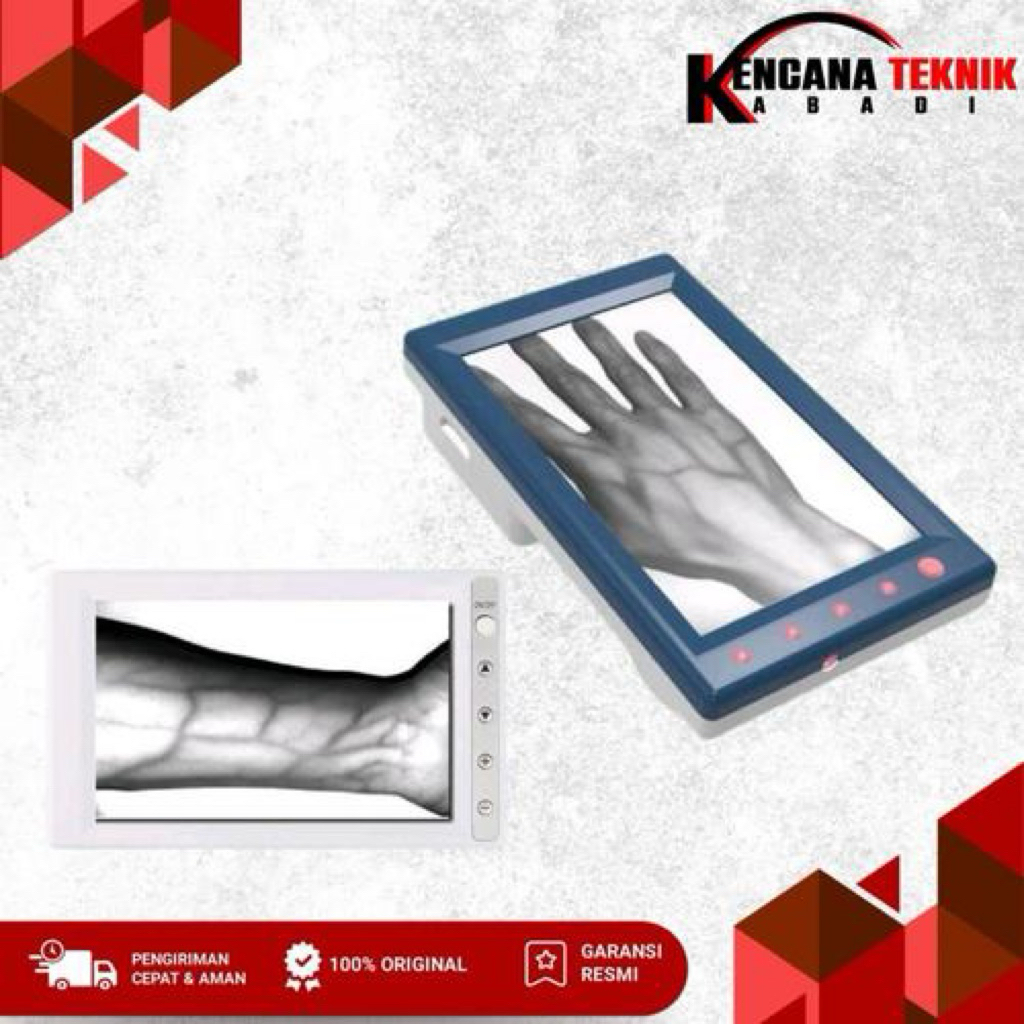 Alat Pencitraan Vena Medis Vena Puncture Menggunakan Vein Viewer Vein Finder
