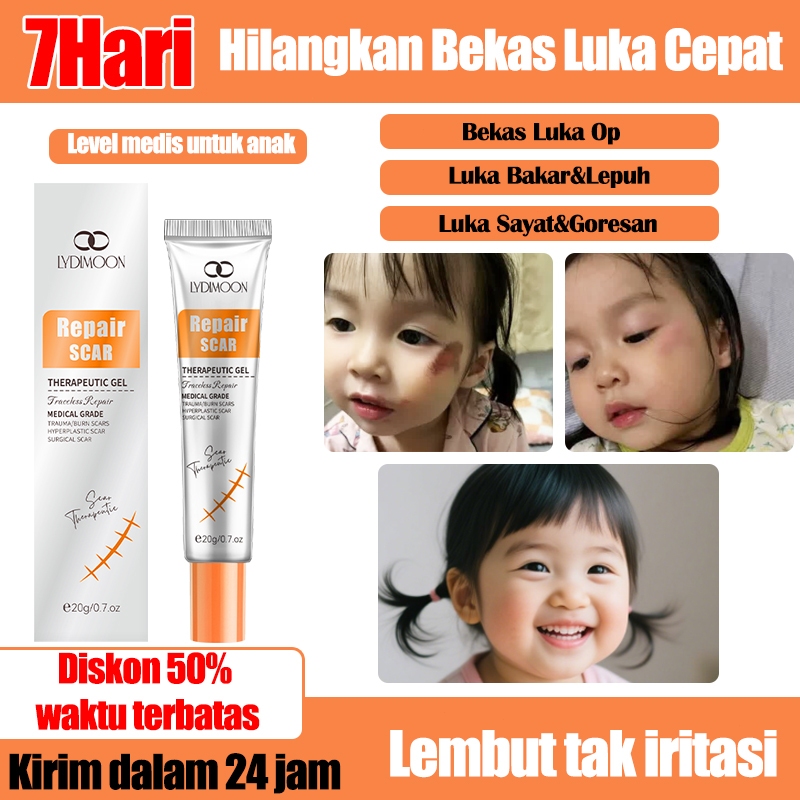 Penghilang Bekas Luka untuk Anak-anak Ampuh/Atasi Luka Koreng  Baker menghilang Bekas Luka Operasi G
