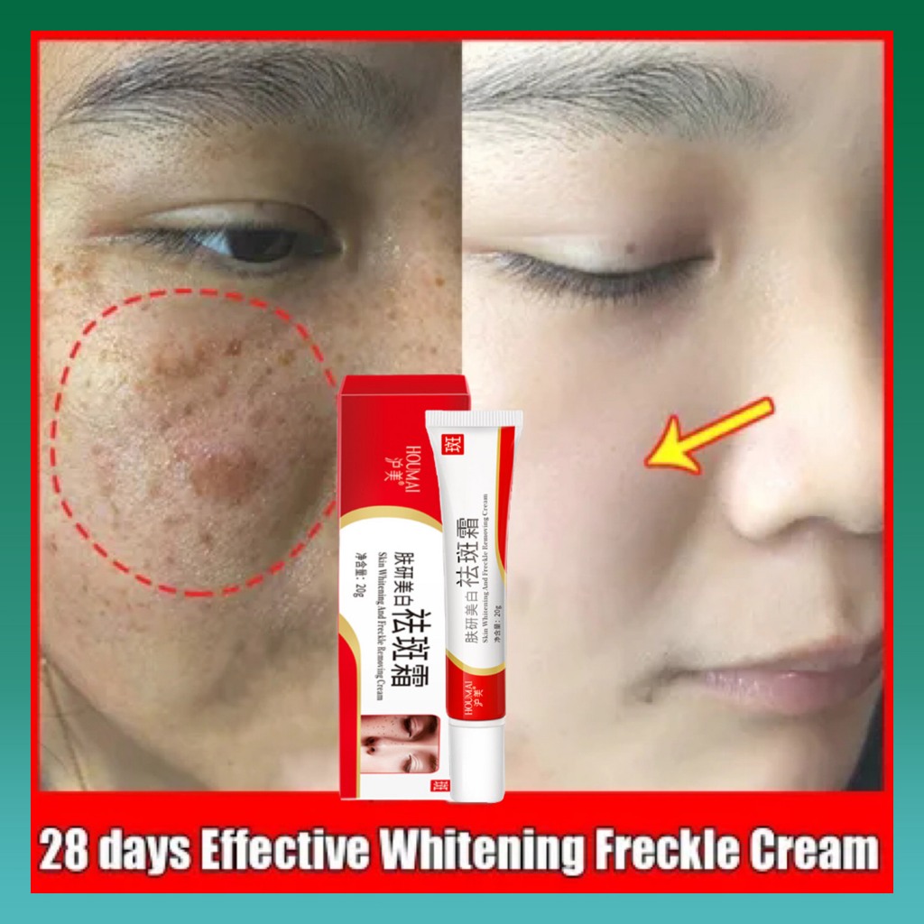 Krim pemutih dan anti-bintik niacinamide 100% asli, krim penghilang bintik hitam, gel anti-jerawat