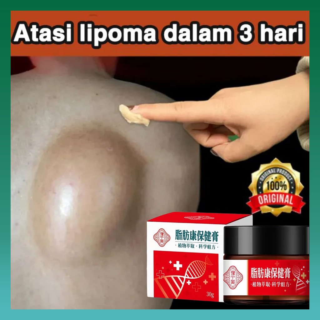 Lipoma removal cream, cosmetic lump medicine Lipoma lump medicine