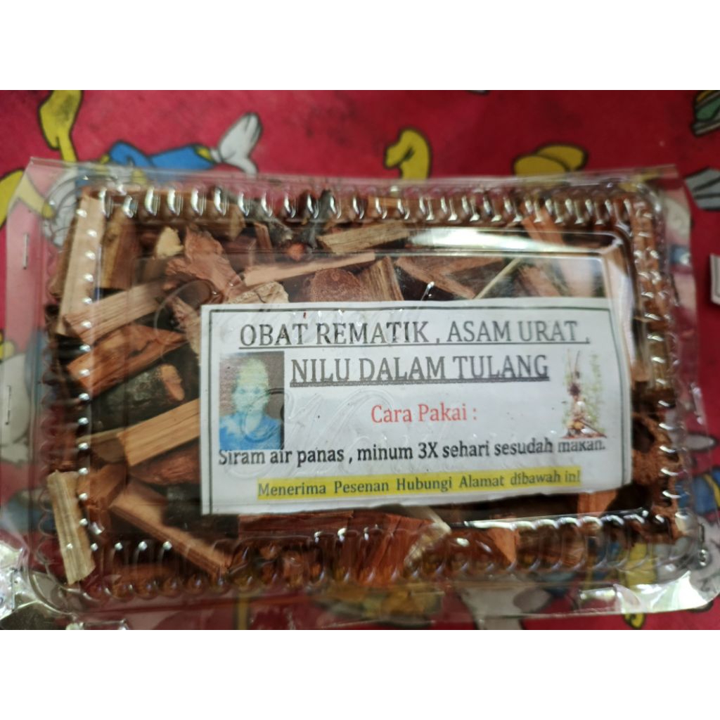 

ramuan rematik, nilu dalam tulang, asam urat