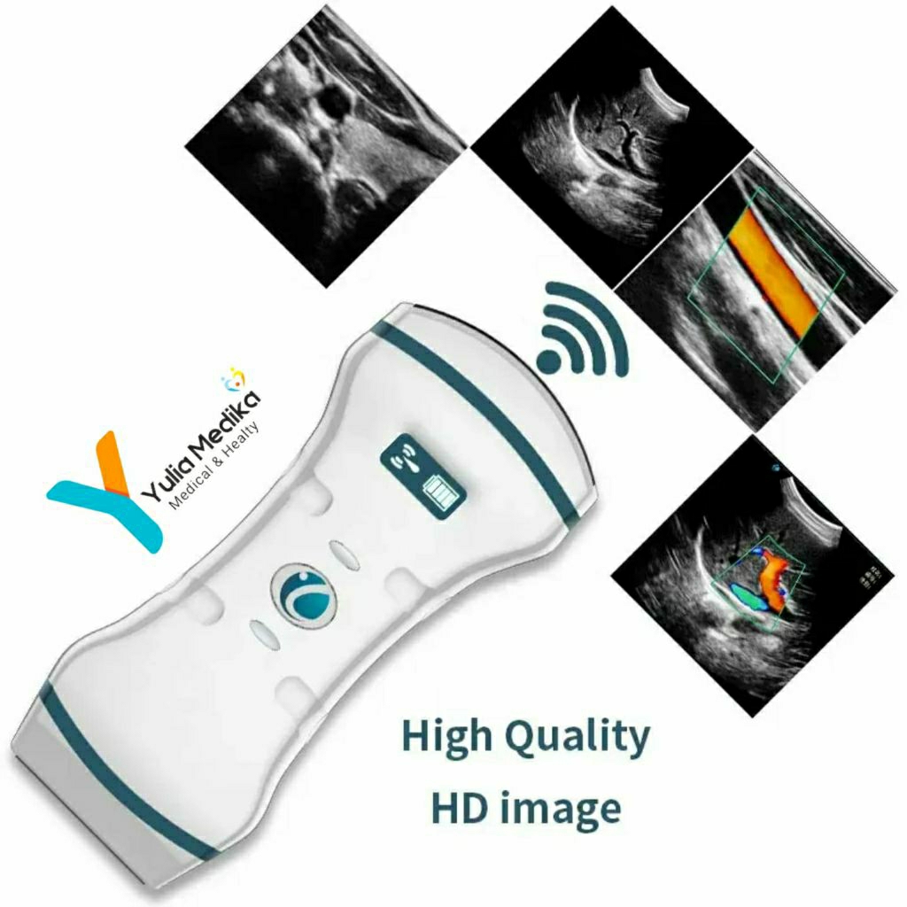 USG Wireless Power Doppler / USG Genggam Ultrasound Doppler