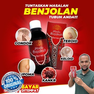 

Madu Bajakah Borneo Teuku Wisnu Ampuh Atasi Benjolan, Kelenjar, Kanker, Miom,