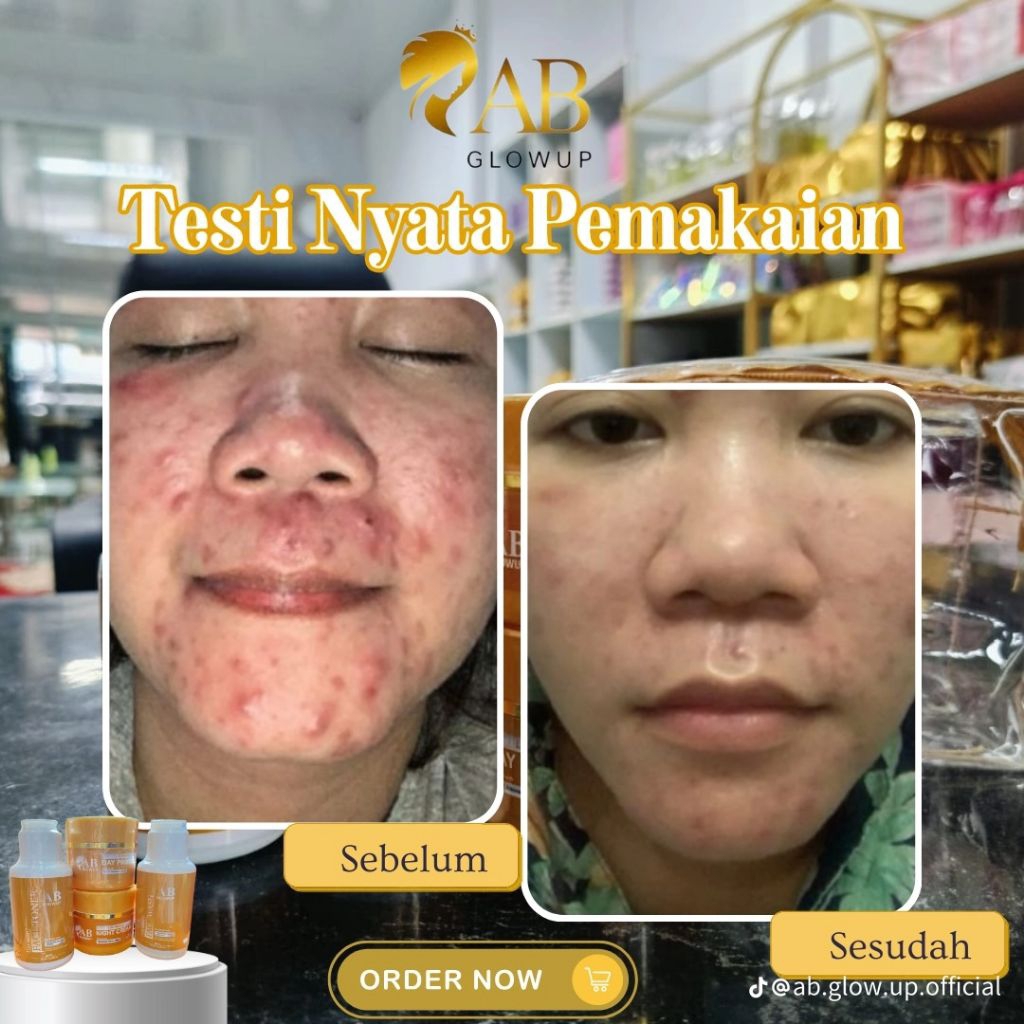 Ab glow up by avril glow up