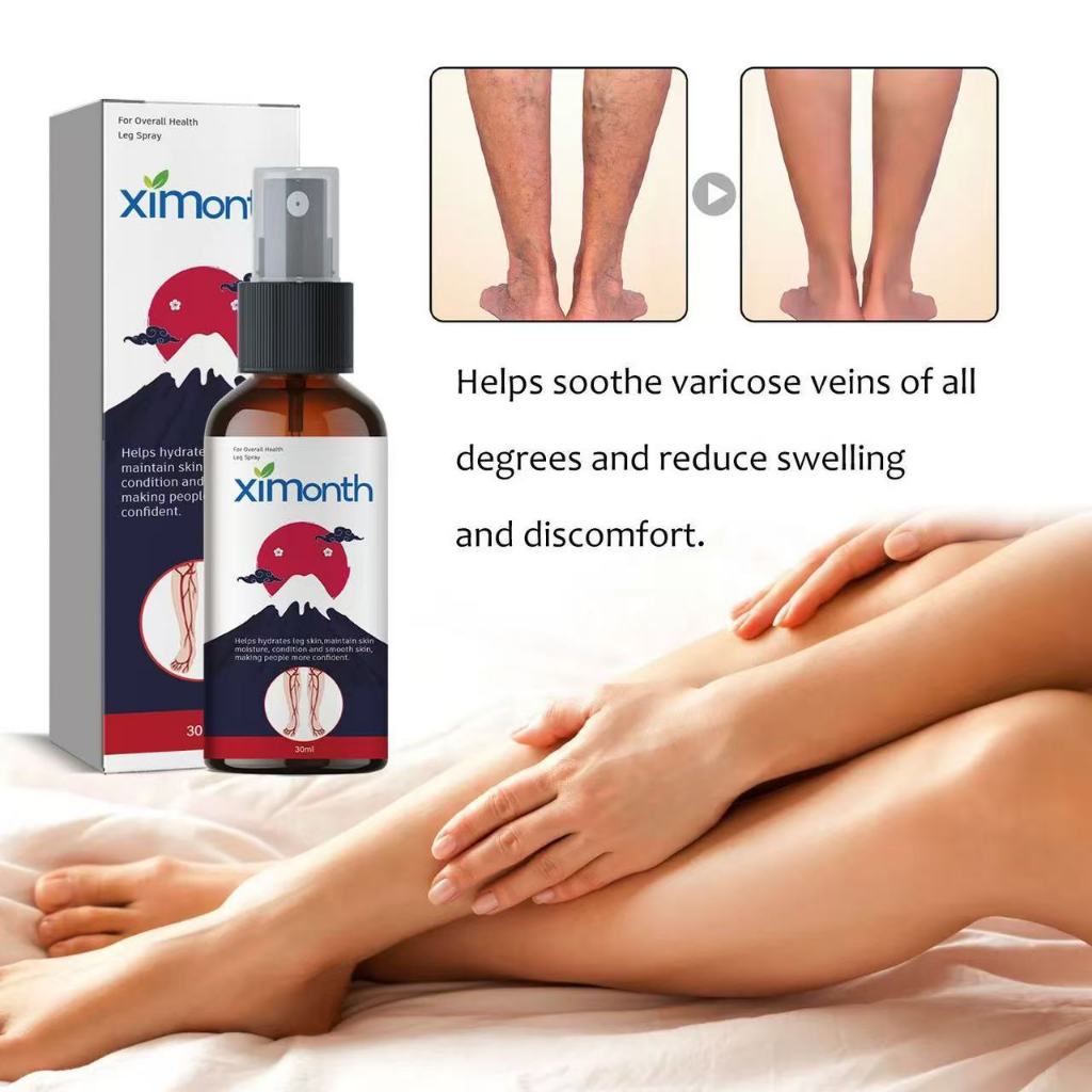 Varicose Veins Spray 30ml Varicose Veins Cream Obat Varises Di Kaki Dan Betis Ampuh Salep Varises sa