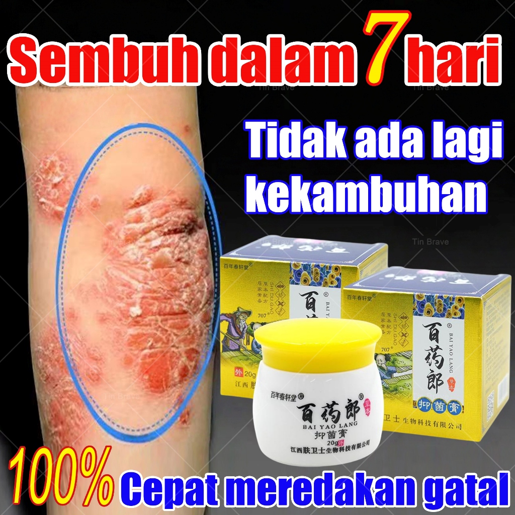 salep gatal anti jamur salep gatal eksim paling ampuh salep gatal selangkangan psoriasis cream obat 
