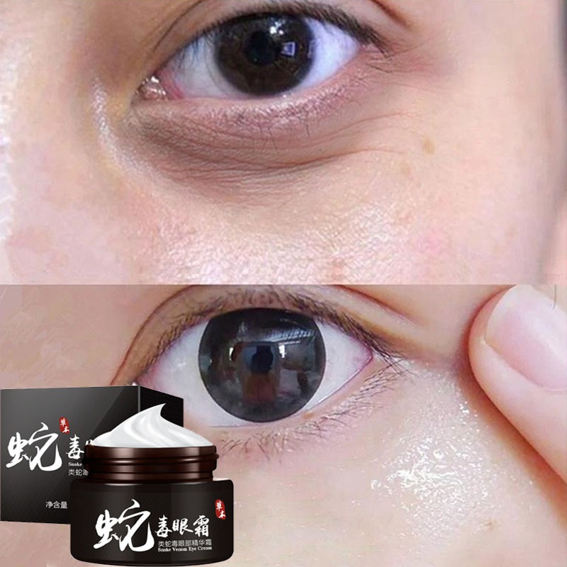Krim mata racun ular Mata hitam Krim mata anti penuaan Penuaan Serum Mata Penghilang meredakan bengk