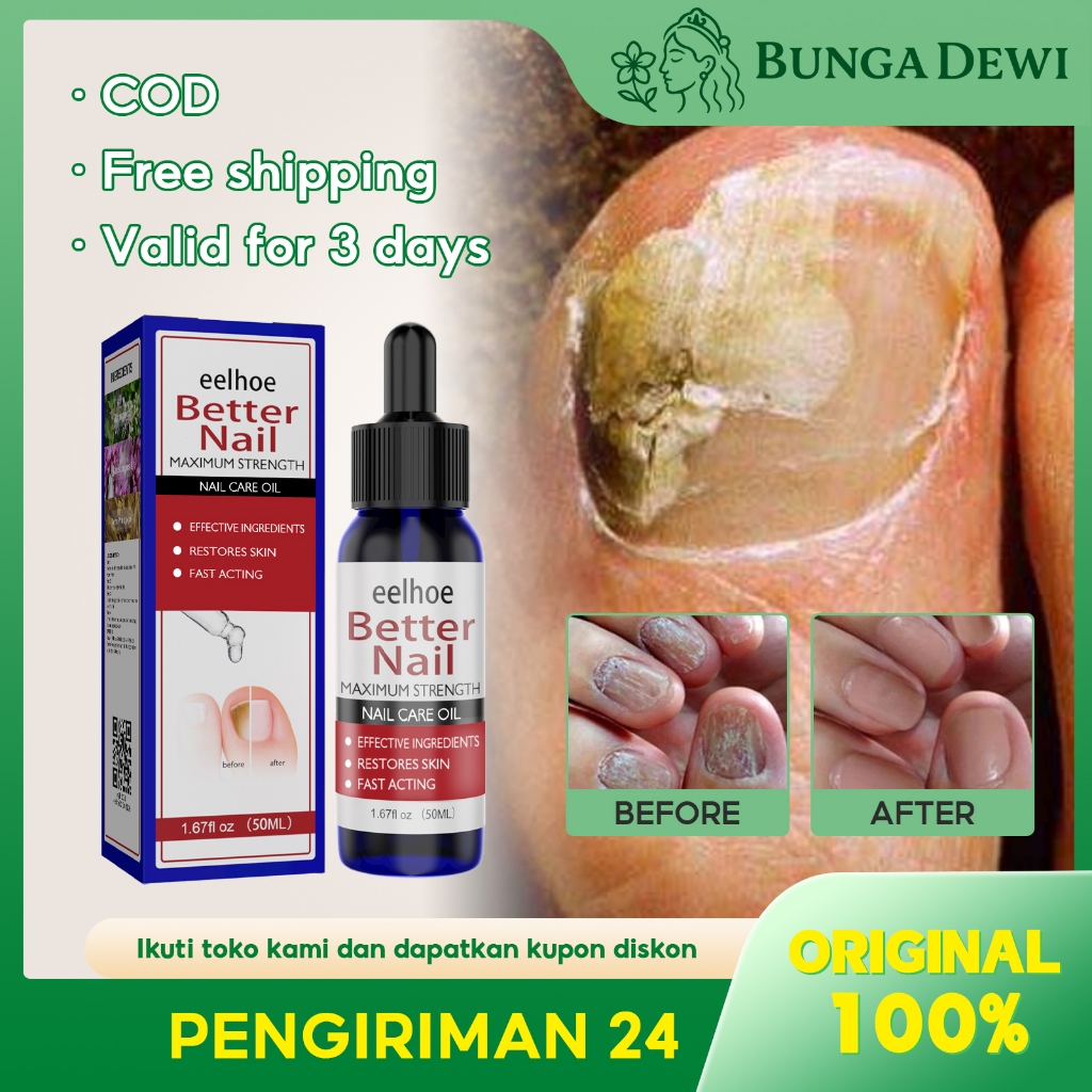 EELHOE Obat Jamur Kuku 50ml Obat Kuku Jamur Dan Rusak Obat Jamur Selangkangan Obat Jamur Obat Jamur 