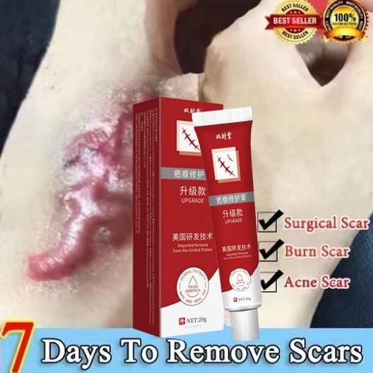 Salep Bekas Luka Obat Penghilang Bekas Luka Salep Penghilang Bekas Luka Bekas Gigitan Nyamuk Bekas L