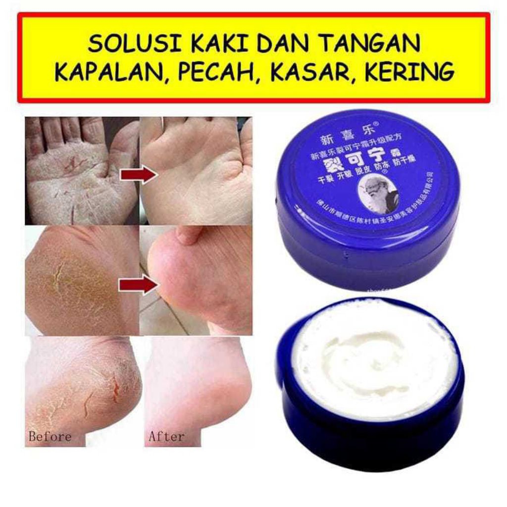 Krim Herbal China - Menghaluskan Melembutkan Kaki dan Tangan - Kapalan Pecah Kasar Kering - Krim Kak