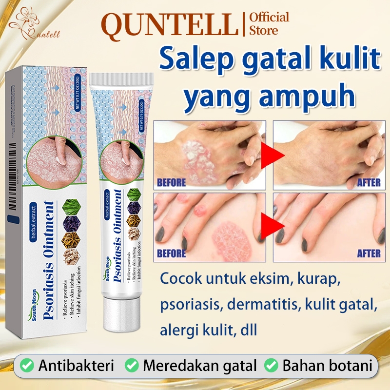 QUNTELL Salep Eksim Kering Paling Ampuh Psoriasis Cream Obat Gatal Kulit Obat Gatal Selangkangan Dan