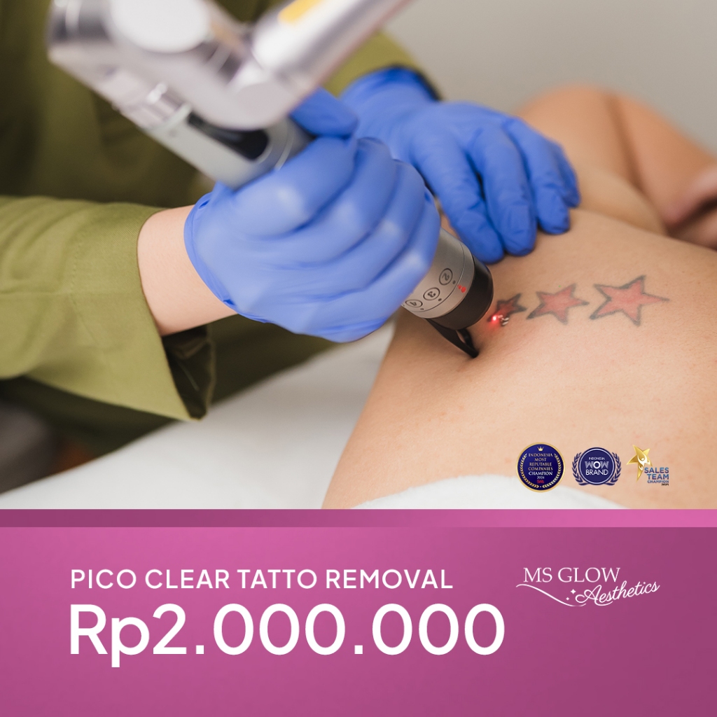 MS Glow Clinic Laser Pico Clear Tatto Removal