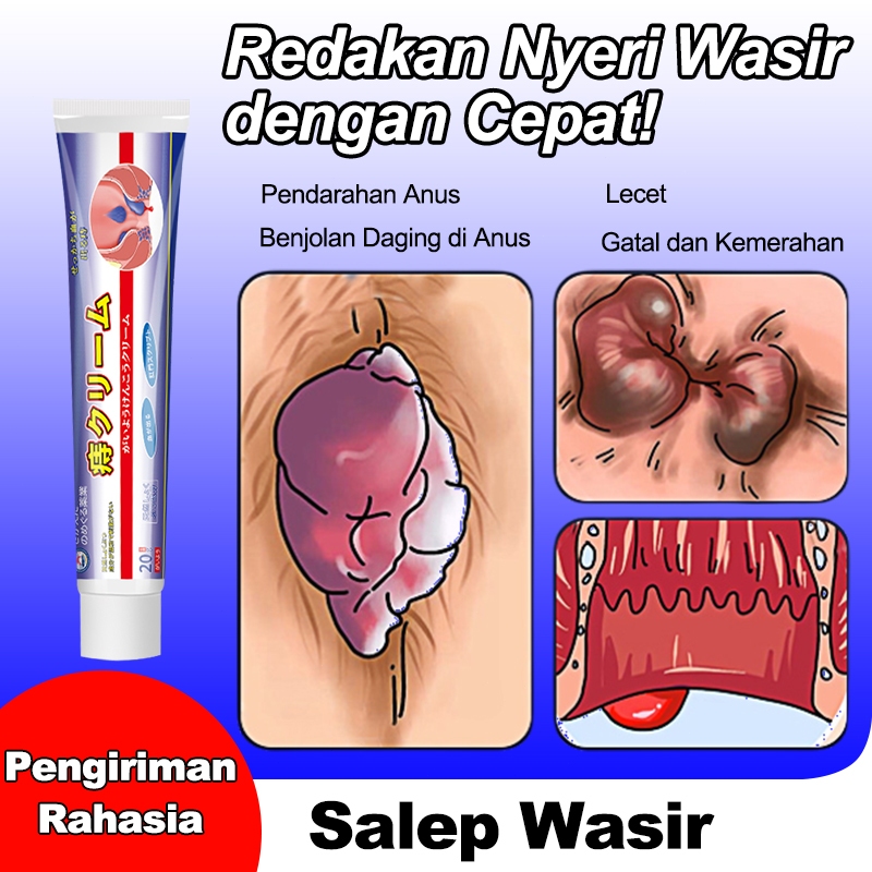 Jepang Obat wasir Salep wasir Salep ambeien paling ampuh 20g Meredakan ketidaknyamanan wasir Formula