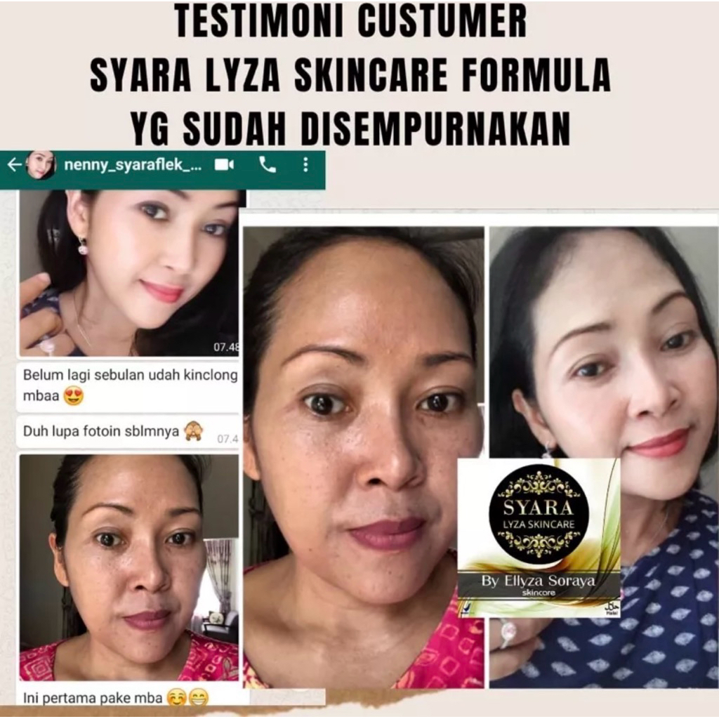 PAKET GOLD crem Flek bandel syara lyza skincare