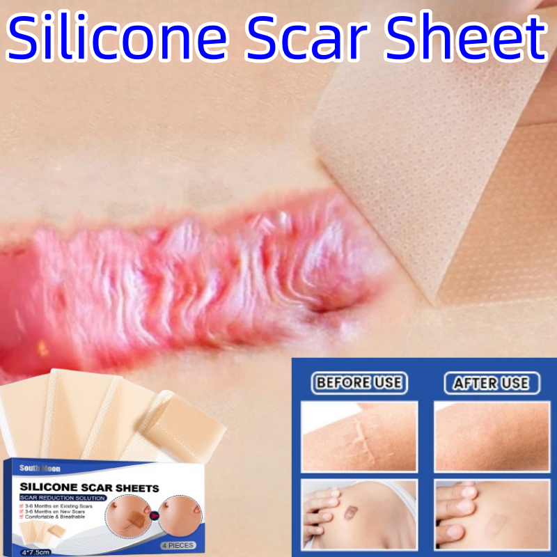 Plester keloid penghilang bekas luka Silicone Scar Sheet silicone gel keloid menghilangkan bekas