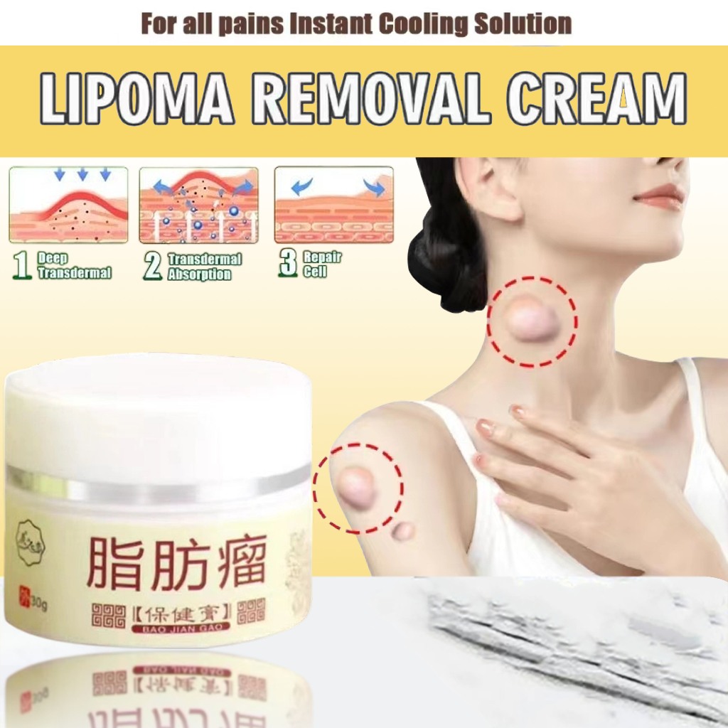 Obat Benjolan Lipoma Obat Herbal Cina Krim Lipoma 30g Perawatan Punggung/Leher/Paha Kanker Tumor Kel