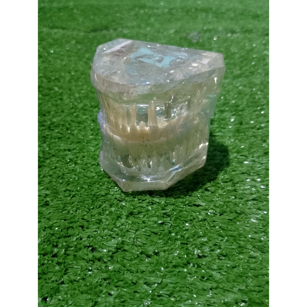 DENTAL MODEL STUDY/ANATOMI GIGI / MODEL STUDY EDUKASI TRANSPARAN STUDI IMPLANT PHANTOM CROWN