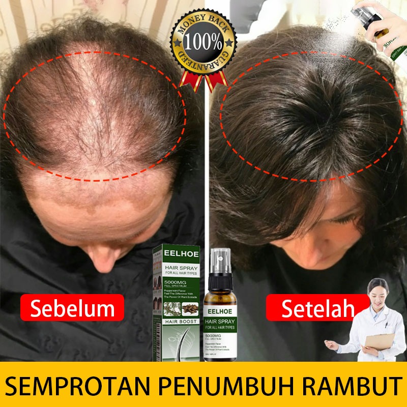 Hair serum rambut rontok Obat penumbuh rambut Semprotan penumbuh rambut Penumbuh rambut Anti rontok 