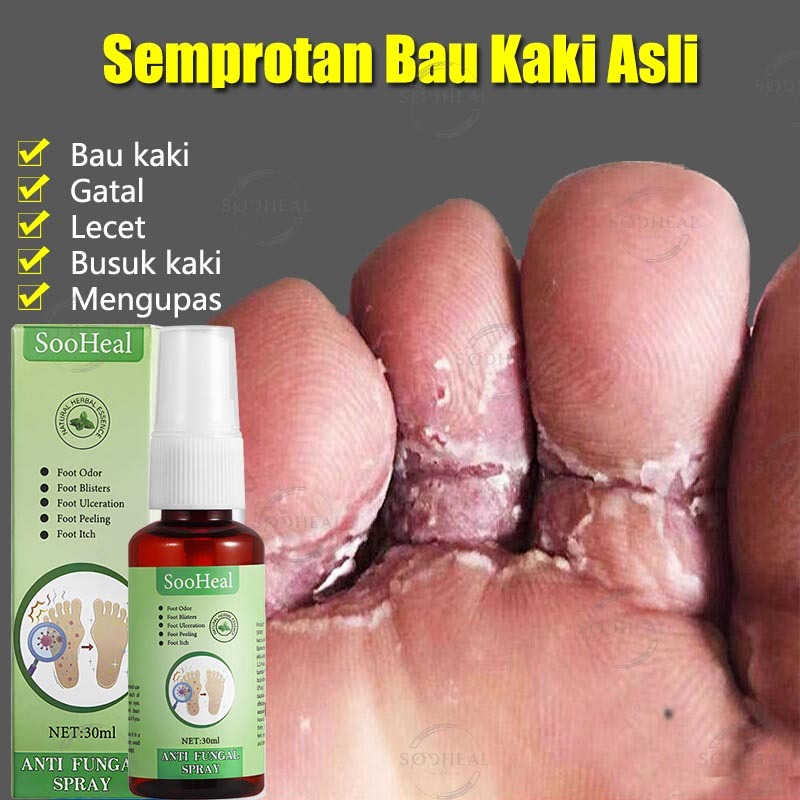 NEW Penghilang bau kaki Penghilang bau sepatu Deodorant spray Obat gatal kaki Bau kaki Gatal kaki