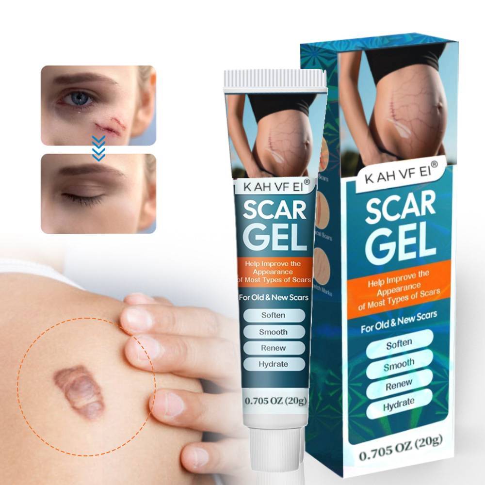 [ORI 100% ] Salep bekas luka Obat penghilang bekas luka keloid penghilang bekas luka hitam koreng me