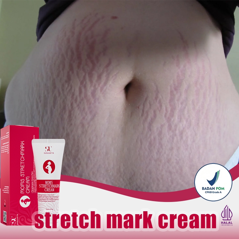 Stretch Mark Cream Cream Stretch Mark Paling Ampuh Strechmark Cream 40G Cream Stretch Mark Salep