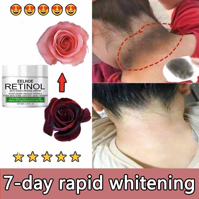 Ay00! pemutih selangkangan ampuh 50ML memutihkan selangkangan hitam pemutih ketiak dan selangkangan