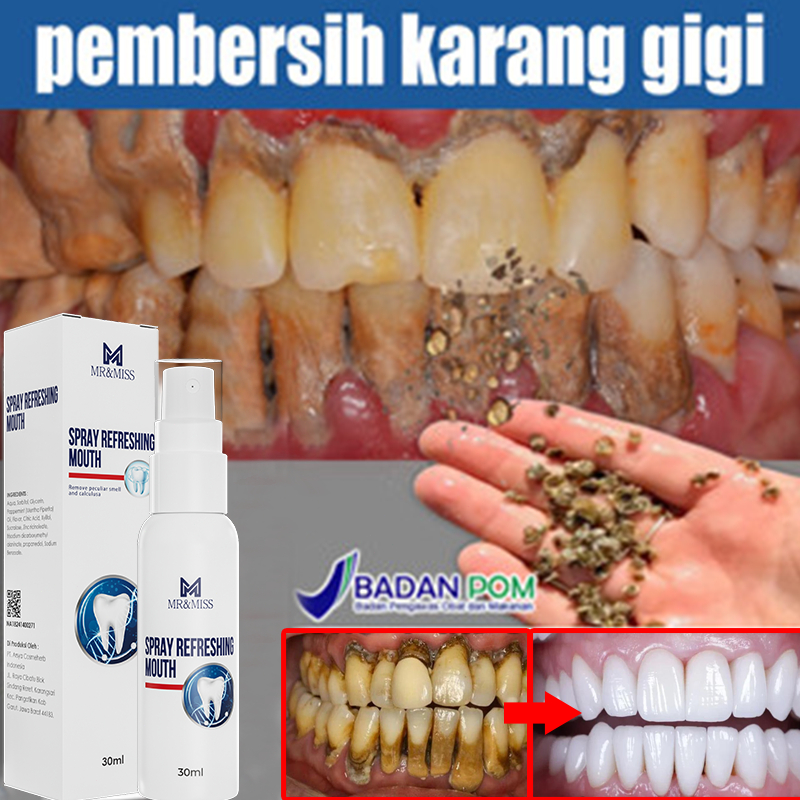 Pemutih gigi Pembersih karang gigi Odol pemutih gigi dan karang gigi 30ml alat pembersih karang gigi