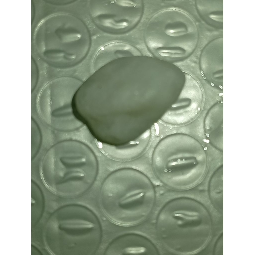 batu empedu belut putih