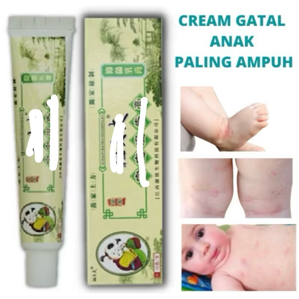 SALEP GATEL ZUDAIFU UNTUK ANAK SALEP GATAL SALEP ANAK SALEP ZUDAIFU SALEP ALERGI COD SALEP ANAK ANAK