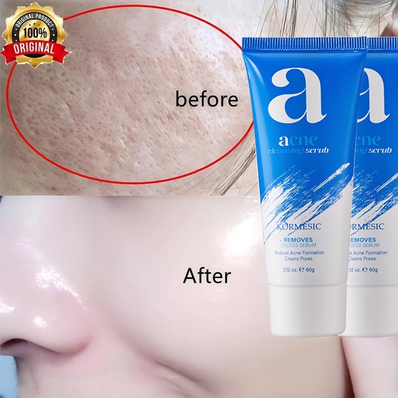 【BPOM】 Acne Cleanser Scrub 60g BPOM Acnes Facial Wash Sabun Cuci Muka Jerawat Sabun muka glowing dan