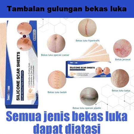 SCAR STICKER -  scar sheet stiker obat bekas luka penghilang bekas luka plester  - Kulit Tahan Air P