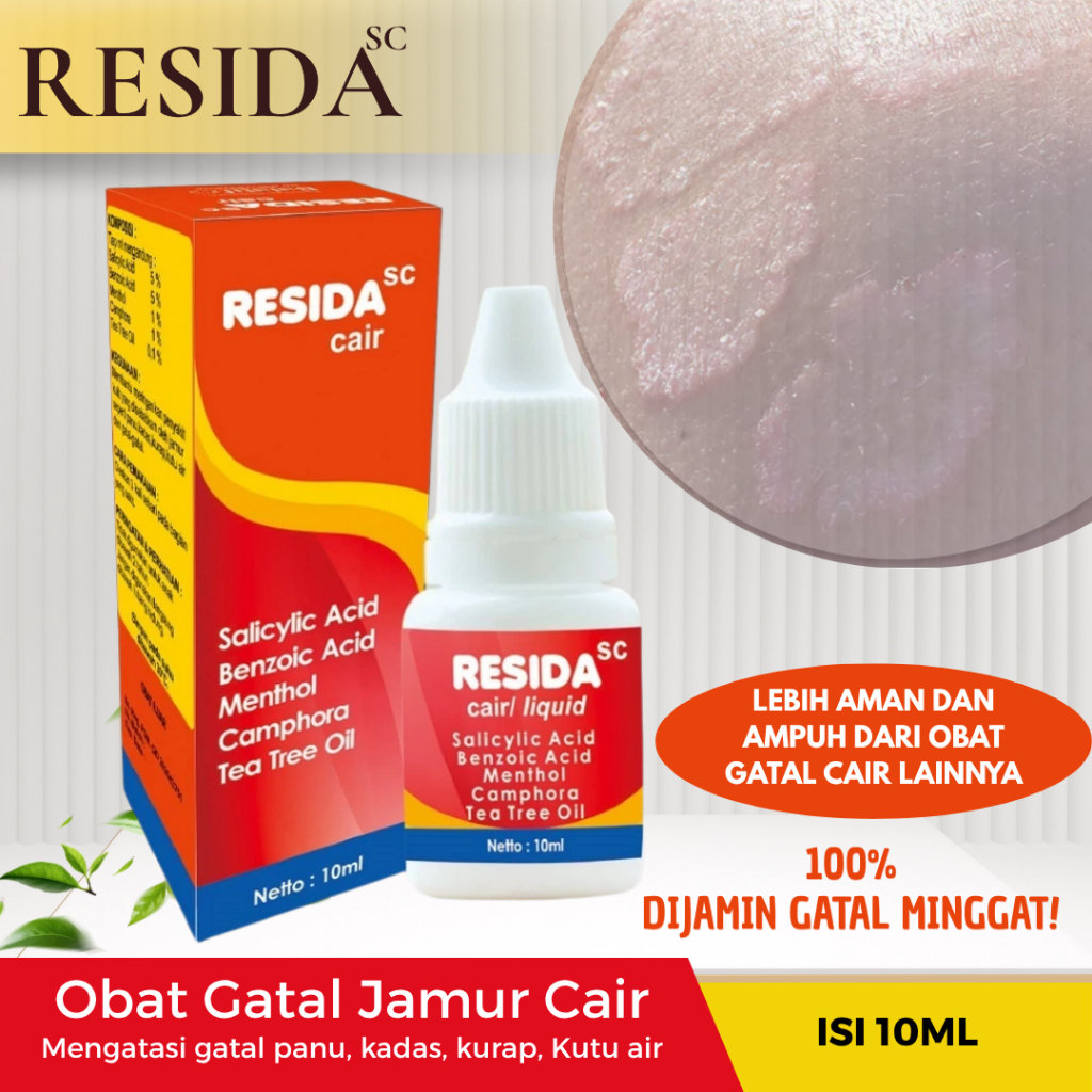 (Bayar COD) RESIDA SC CAIR Obat Gatal Kulit Panu Kadas Kutu Air RINGWORM ALERGI Gatal Gatal di kaki