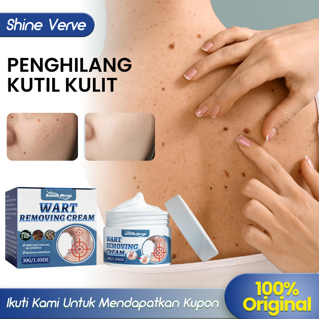 South Moon【ORI/Beli 2 Gratis1】Penghilang Tahi Lalat 30g Obat Kutil Ampuh Salep Kutil Paling Wajah Ta
