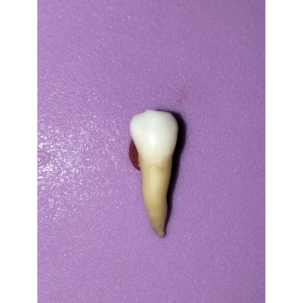 Gigi asli premolar 35