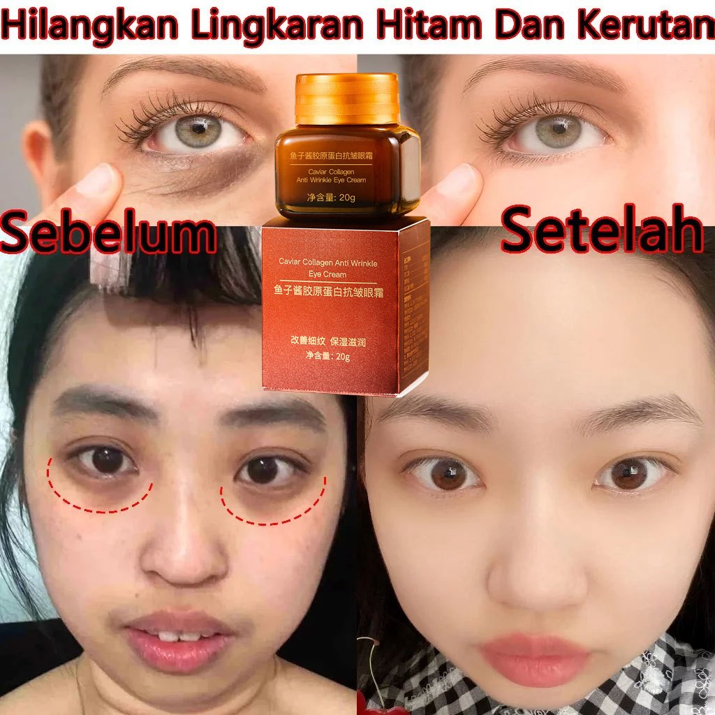 Caviar Collagen Anti Wrinkle Eye Cream 20g Mengurangi Garis Halus Bawah Mata Kulit Tegas Menghilangk