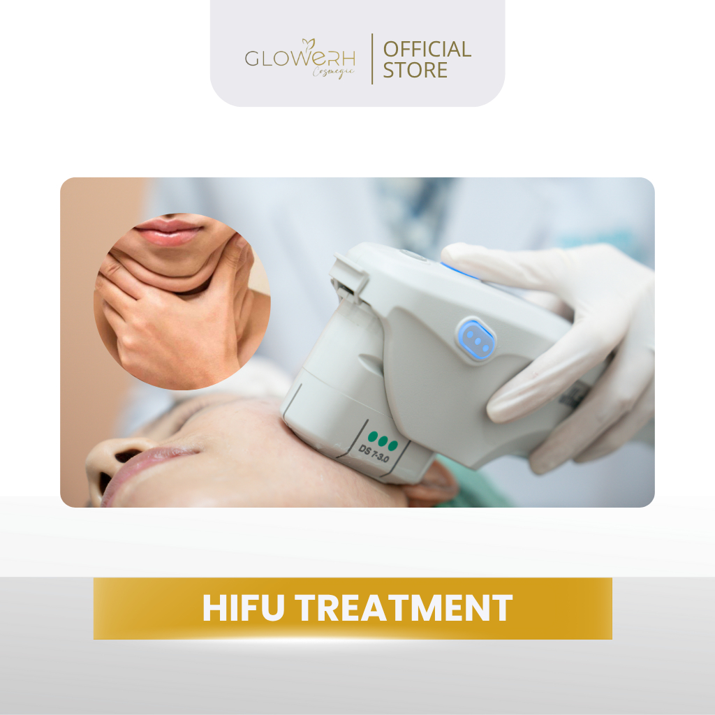 Glowerh Hifu Pipi dan Doublechin Treatment