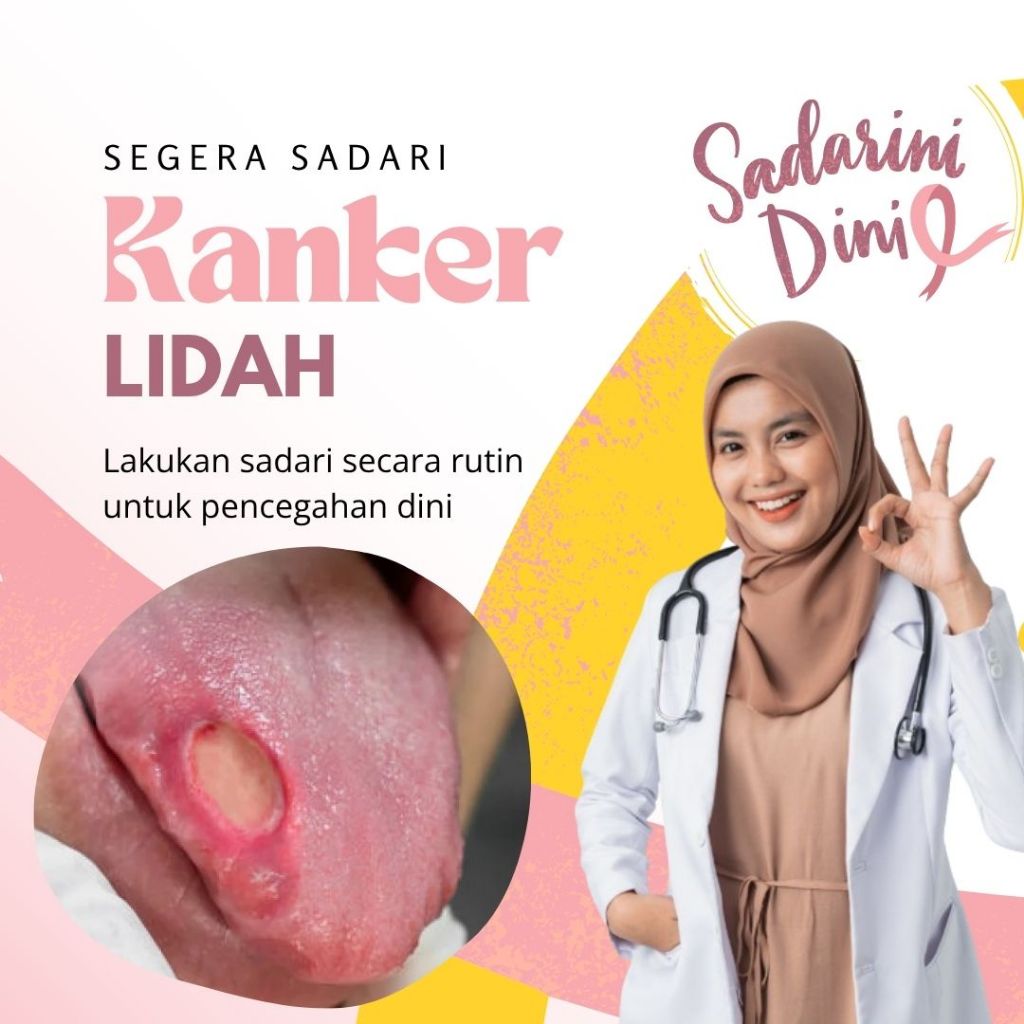 Xamthone Plus – Obat Herbal Kanker Lidah Alami | Ekstrak Kulit Manggis