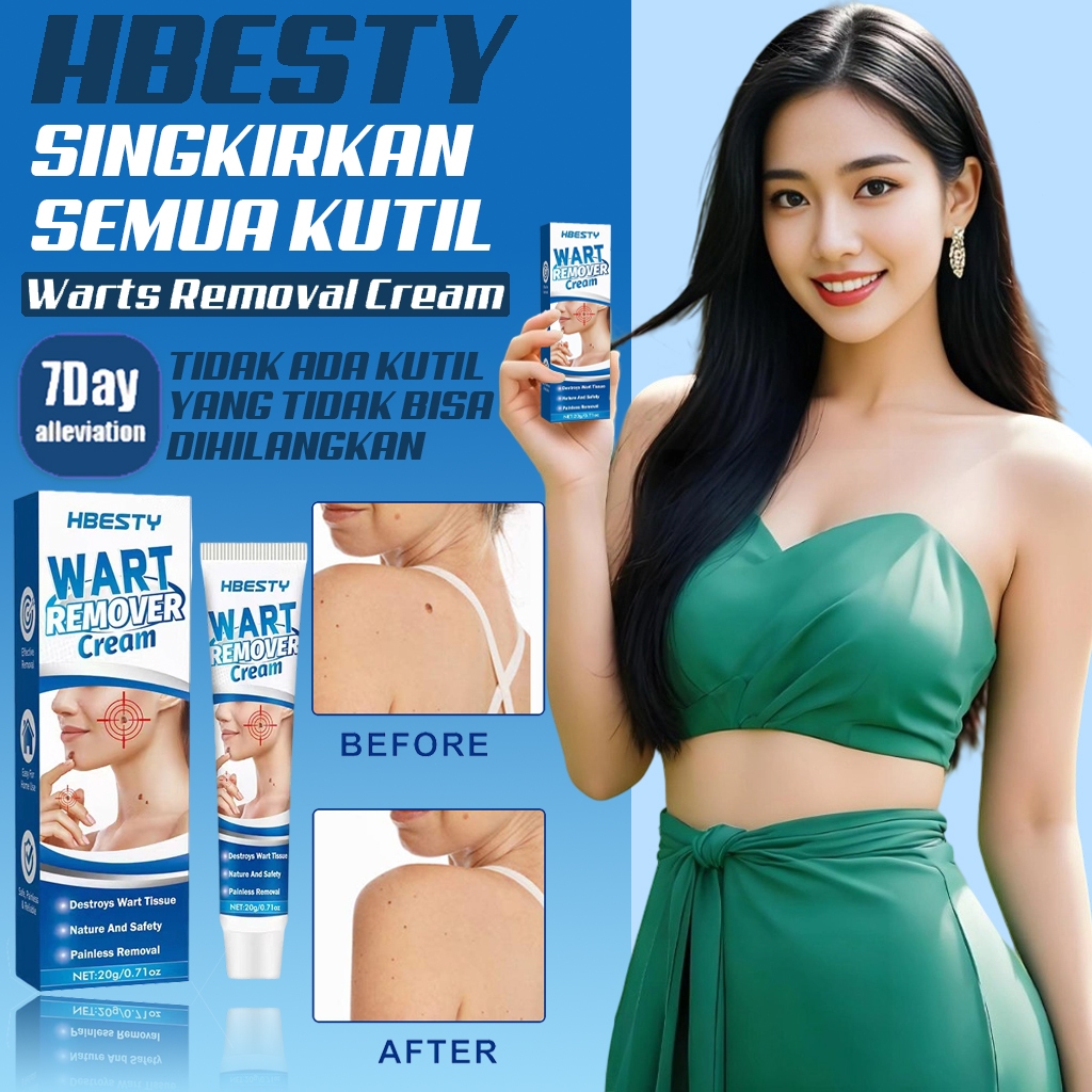Salep Obat Kutil Paling Ampuh - obat kutil Krim Penghilang Kutil paling Mudah Dibawa Untuk Semua Kul