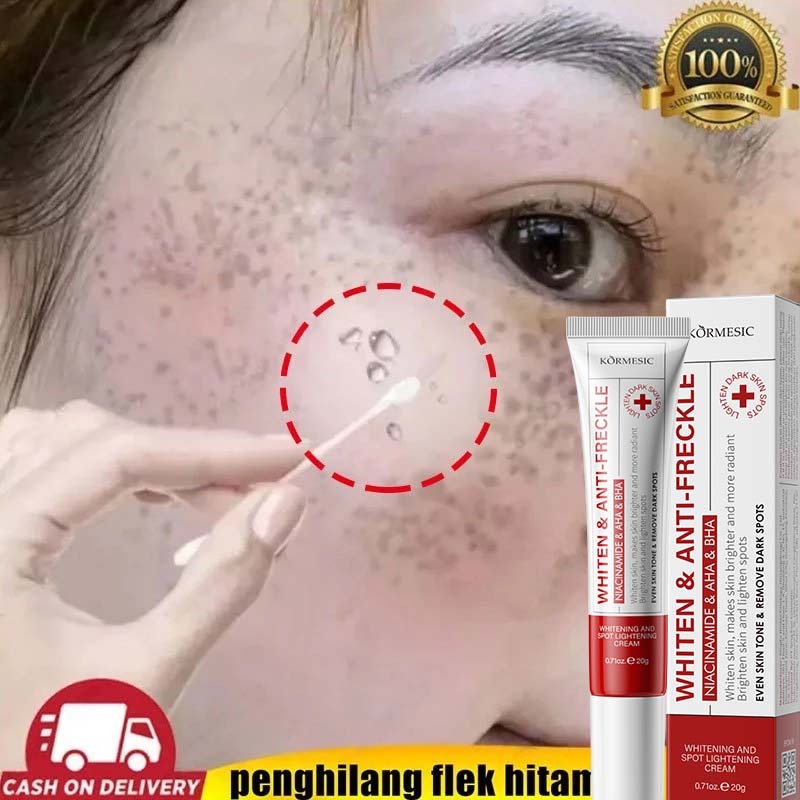 Obat jerawat menghilangkan bekas jerawat penghilang bekas jerawat 20g obat totol jerawat penghilang 