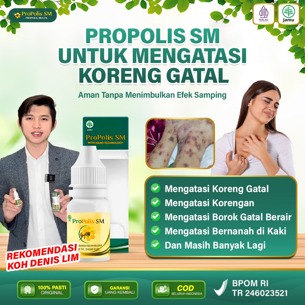 Propolis SM - Obat Koreng Gatal, Herbal Koreng/Korengan - Obat Borok Gatal Berair, Bernanah di Kaki 