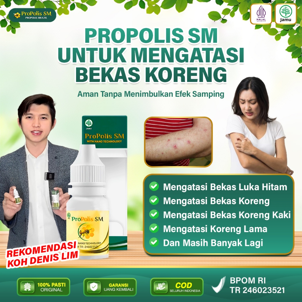 Propolis SM - Obat Kulit Bernanah, Luka Koreng, Obat Koreng Gatal, Korengan, Obat Penyakit Kulit Gat