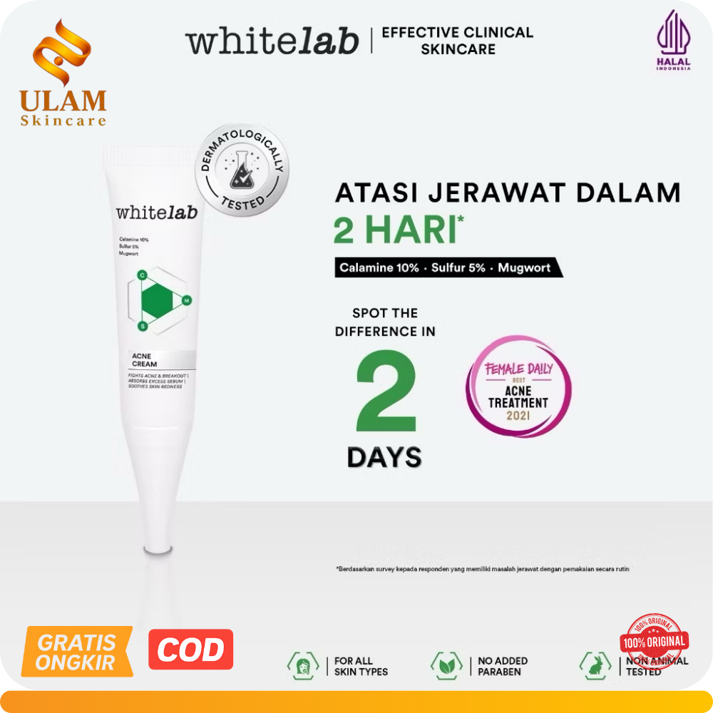 WHITELAB ACNE TREATMENT, Acne Cream Whitelab, Whitelab Acne Calming Serum, Acne Soap Whitelab boat c