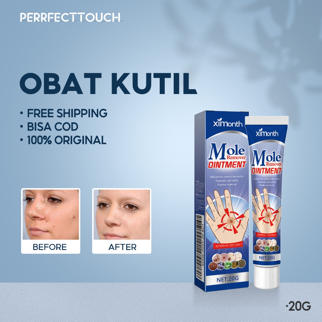 Xi Month Salep Penghilang Tahi Lalat Dan Kutil 20g Krim Penghilang Kutil Krim Penghilang Kutil Wajah