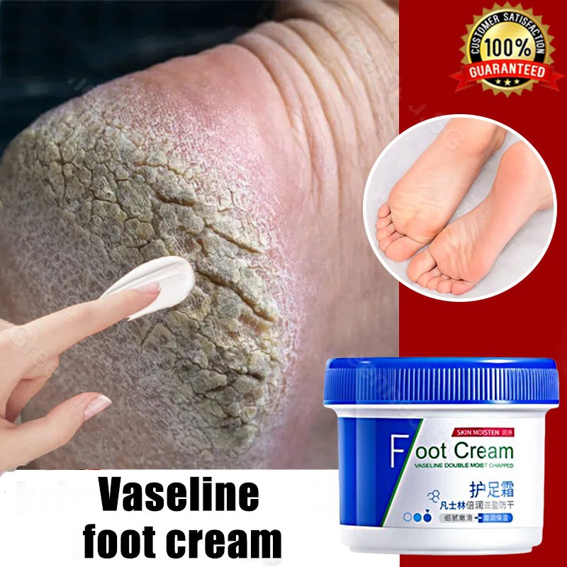 Kering Krim Kaki Obat Kaki Kering Cream dan Kering Tangan Kapalan Amplas Kaki Pecah Vaseline Pelemba
