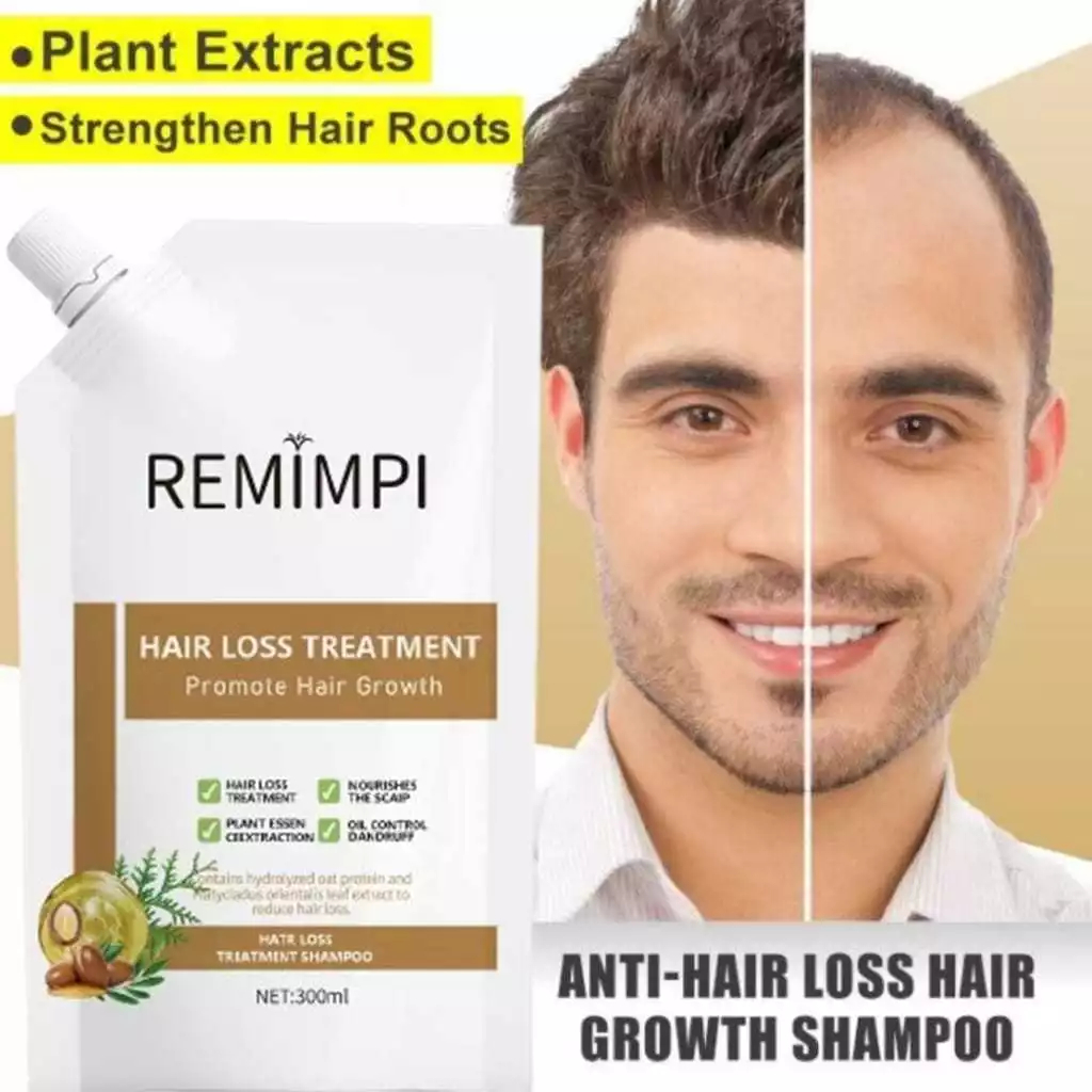 REMIMPI SHAMPOO ANTI HAIR FALL / REMIMPI PENUMBUH RAMBUT / SAMPO REMIMPI RAMBUT RONTOK MENIPIS