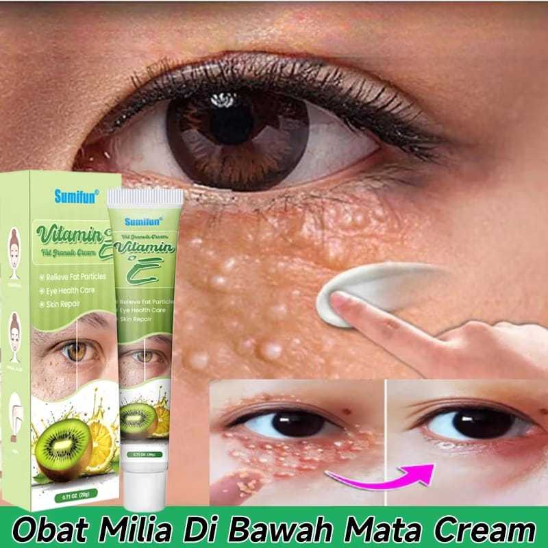 Krim Penghilang Milia Obat Milia Di Bawah Mata Cream Vitamin E Eye Cream / Cream Penghilang Milia