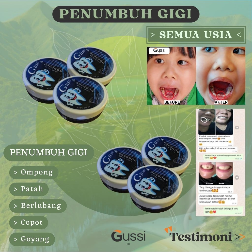 PENUMBUH GIGI PATAH PALING AMPUH SEMUA USIA DAN PEMUTIH GIGI