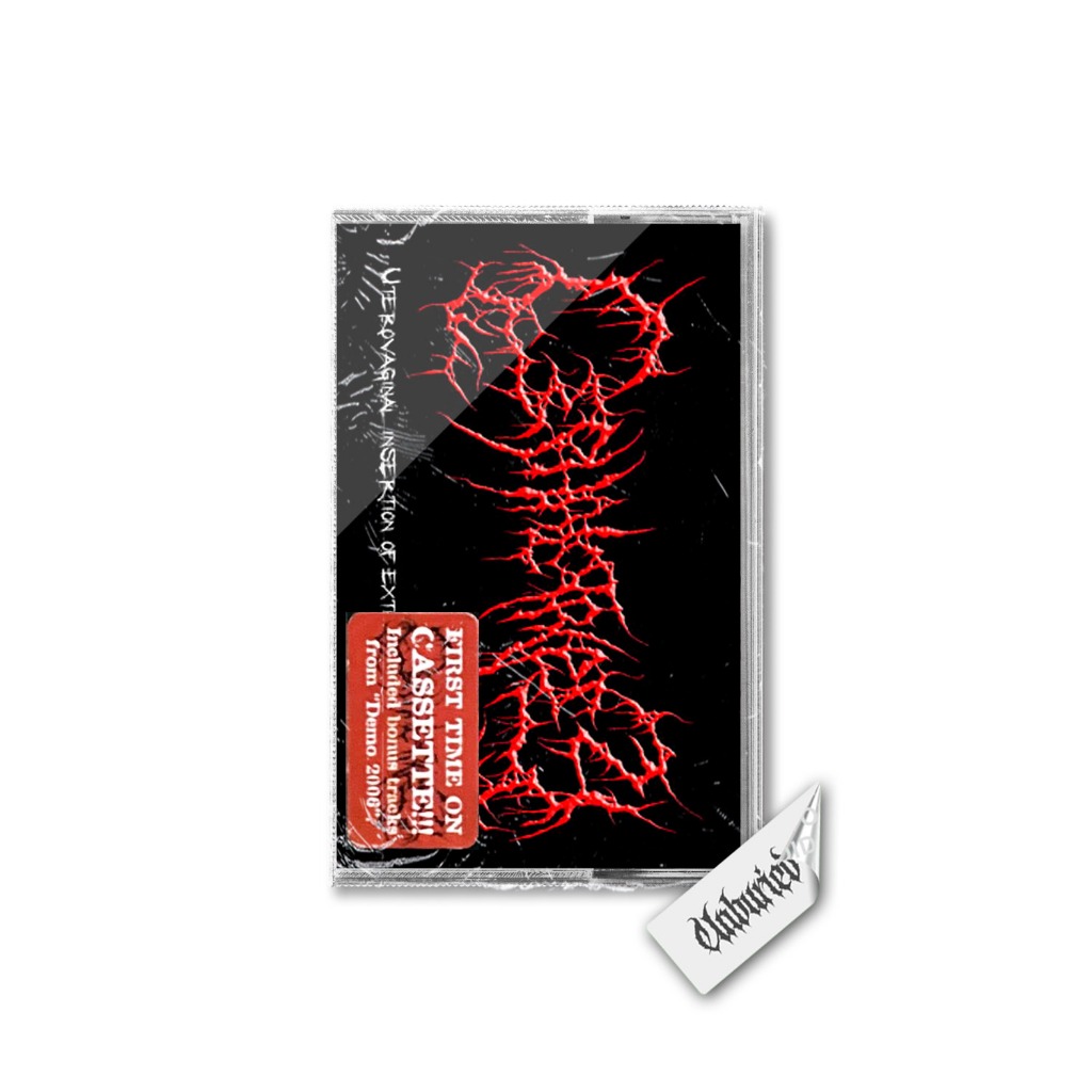 Cassette - Cephalotripsy - Uterovaginal Insertion of Extirpated Anomalies