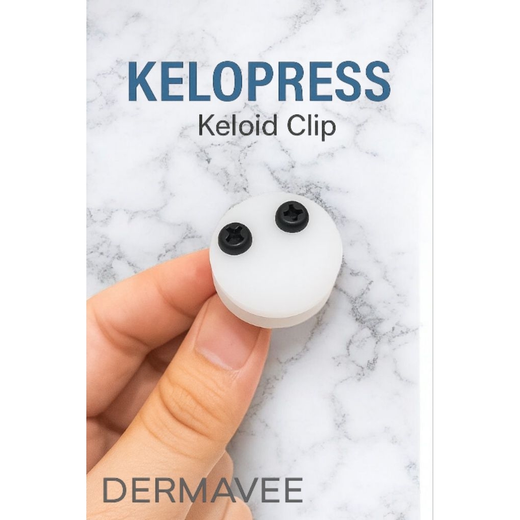 KELOPRESS Luno – Alat Tekan Keloid 1 Set | Kompresi Pasca Operasi & Piercing | Anti Keloid Telinga
